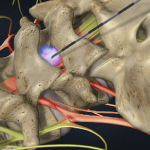 Regenerative medicine relief