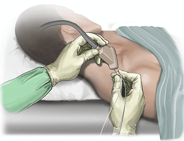 Peripheral Joint Injections