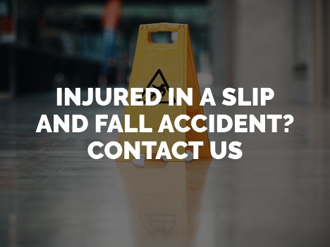 Slip and Fall 