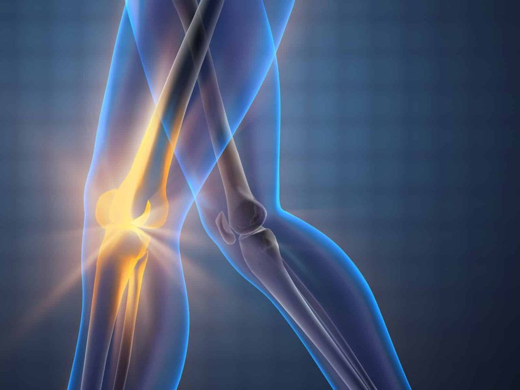 osteoarthritis