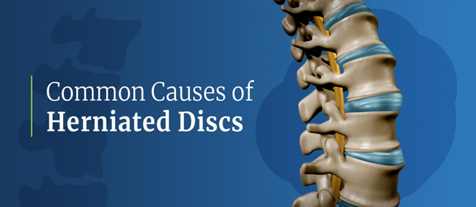 Understanding Disc Herniation Causes and Treatments
