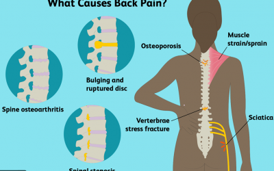 TOP CAUSES OF BACK PAIN
