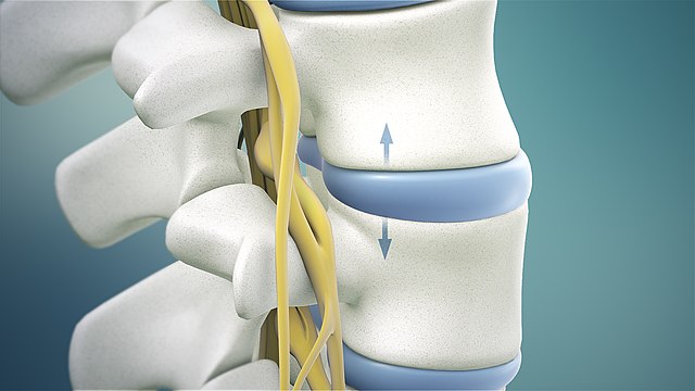 Spinal Decompression in Tampa