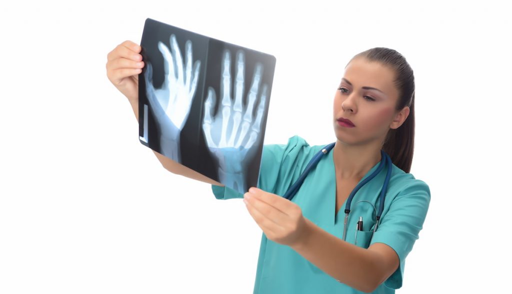 What is Digital Motion X-Ray