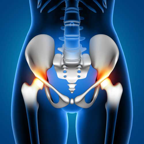 Tendinosis Treatment