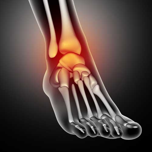 plntar Tenotomy Procedure Tampa FL Tenotomy Procedure Tampa FL,TenJet Tenotomy Wesley Chapel FL,Tenotomy procedure Wesley Chapel,TenJet procedure near me,Sports medicine Wesley Chapel FL,Elbow pain treatment Wesley Chapel Wesley Chapel Spine and Sport Medicine