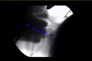 16d875 db7b473bbcd643669b63cb18810e6f73 1 Digital Motion X-Ray Digital Motion X-Ray,DMX,Chiropractic imaging Florida,Sports Injury Imaging Florida,Ligament X-Ray Florida Wesley Chapel Spine and Sport Medicine